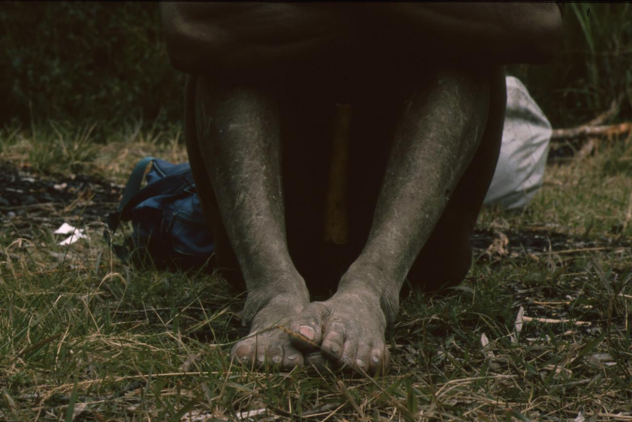 BD/166/206 -
Feet on the grass