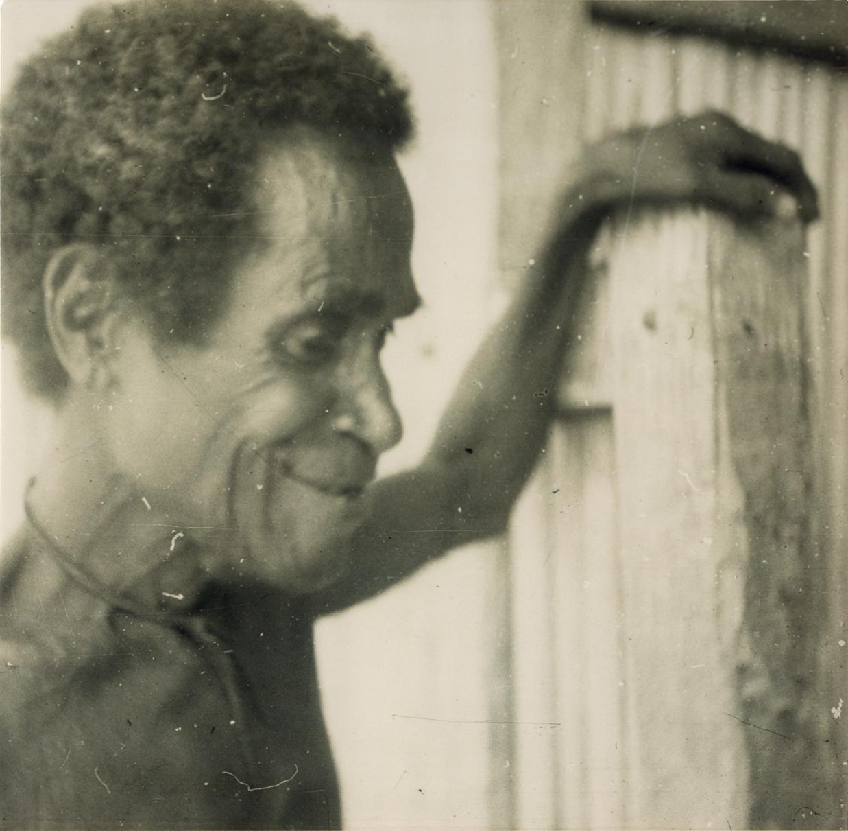 BD/309/26 -
Dorp Sisir, man kijkt toe terwijl meisje been met aandoening toont