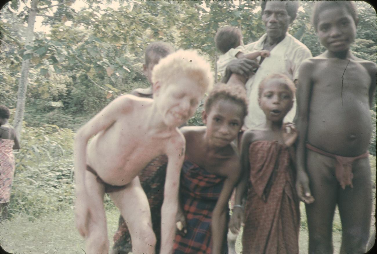 BD/144/67 -
Groepsfoto, onder meer albino-kind
