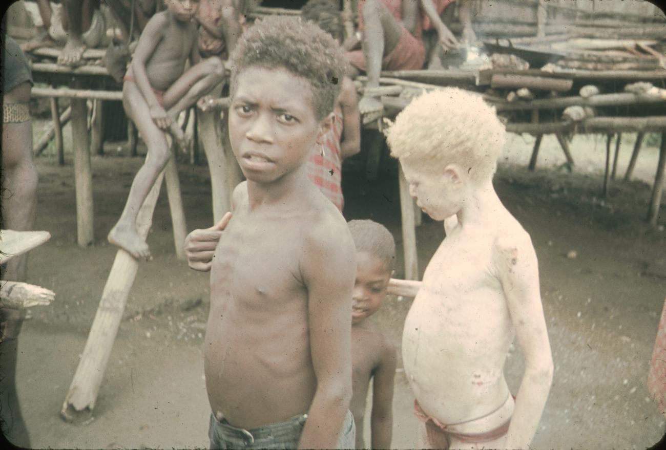 BD/144/73 -
Groepsfoto kinderen zwerfstam, o.m. albino-kind