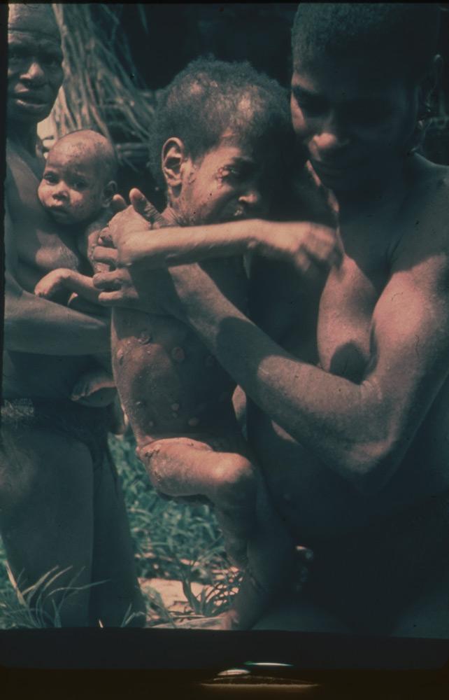 BD/30/39 -
Women take young children to the physician