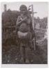 BD/38/5 Vrouw met elephantiasis.