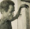 BD/309/26 Dorp Sisir, man kijkt toe terwijl meisje been met aandoening toont